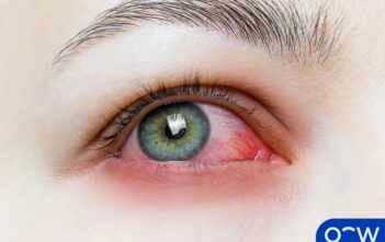 Tecniche per Ridurre l’Eye Strain Usando Dispositivi Digitali Tecniche per Ridurre l’Eye Strain Usando Dispositivi Digitali