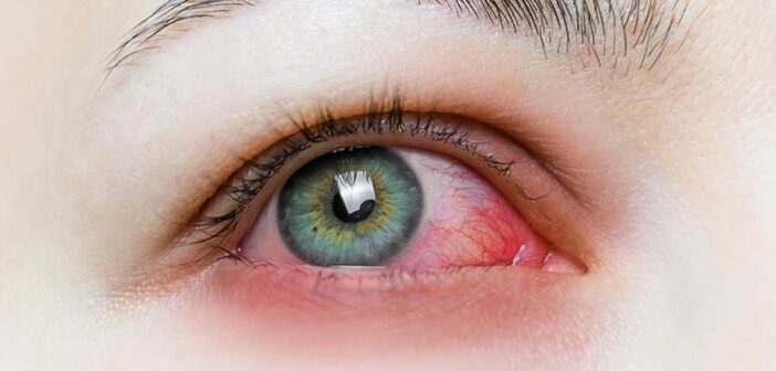 Tecniche per Ridurre l’Eye Strain Usando Dispositivi Digitali